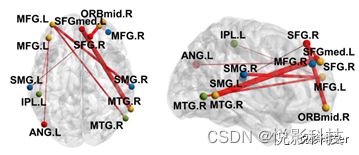 FNIRS功能近紅外數據處理服務